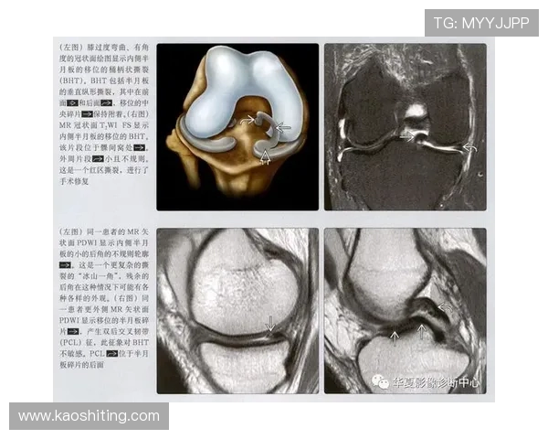 河南队徐嘉敏右膝前交叉韧带撕裂外侧半月板损伤赛季报销 河南队徐嘉敏右膝前交叉韧带撕裂外侧半月板损伤赛季报销